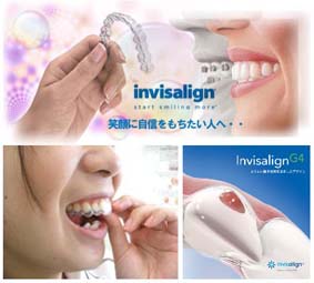 invisalign-blog2.jpg